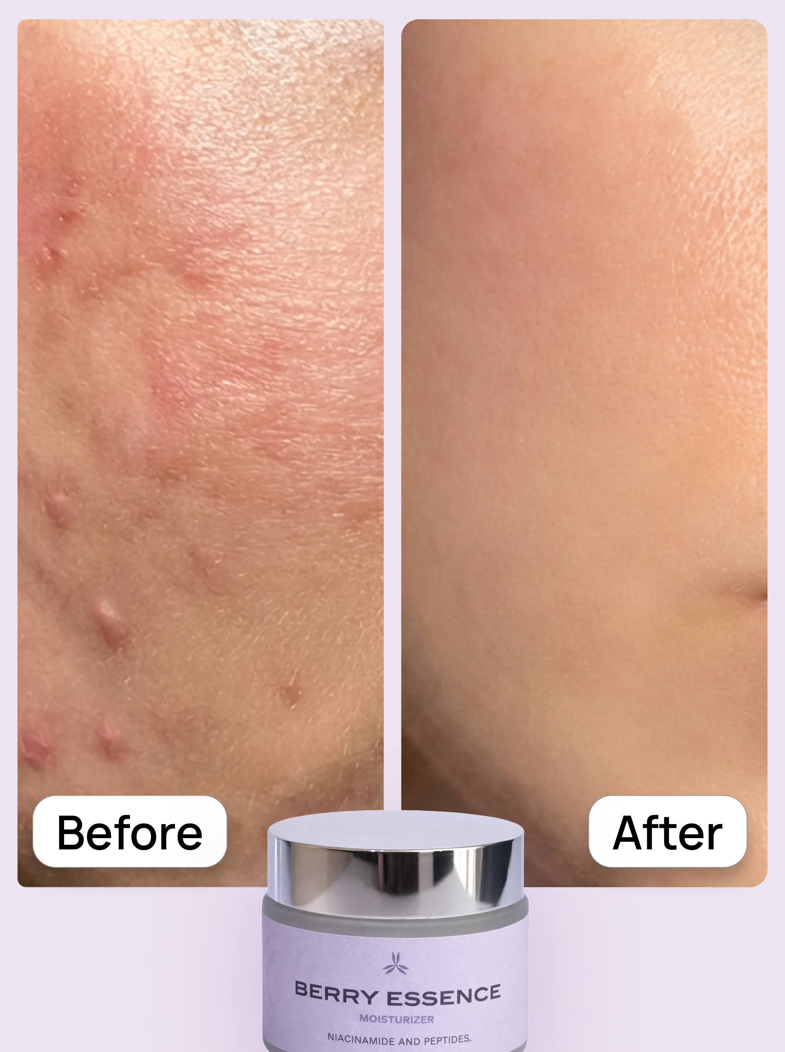 Before and after comparison of skin with a jar of Berry Essence cream.