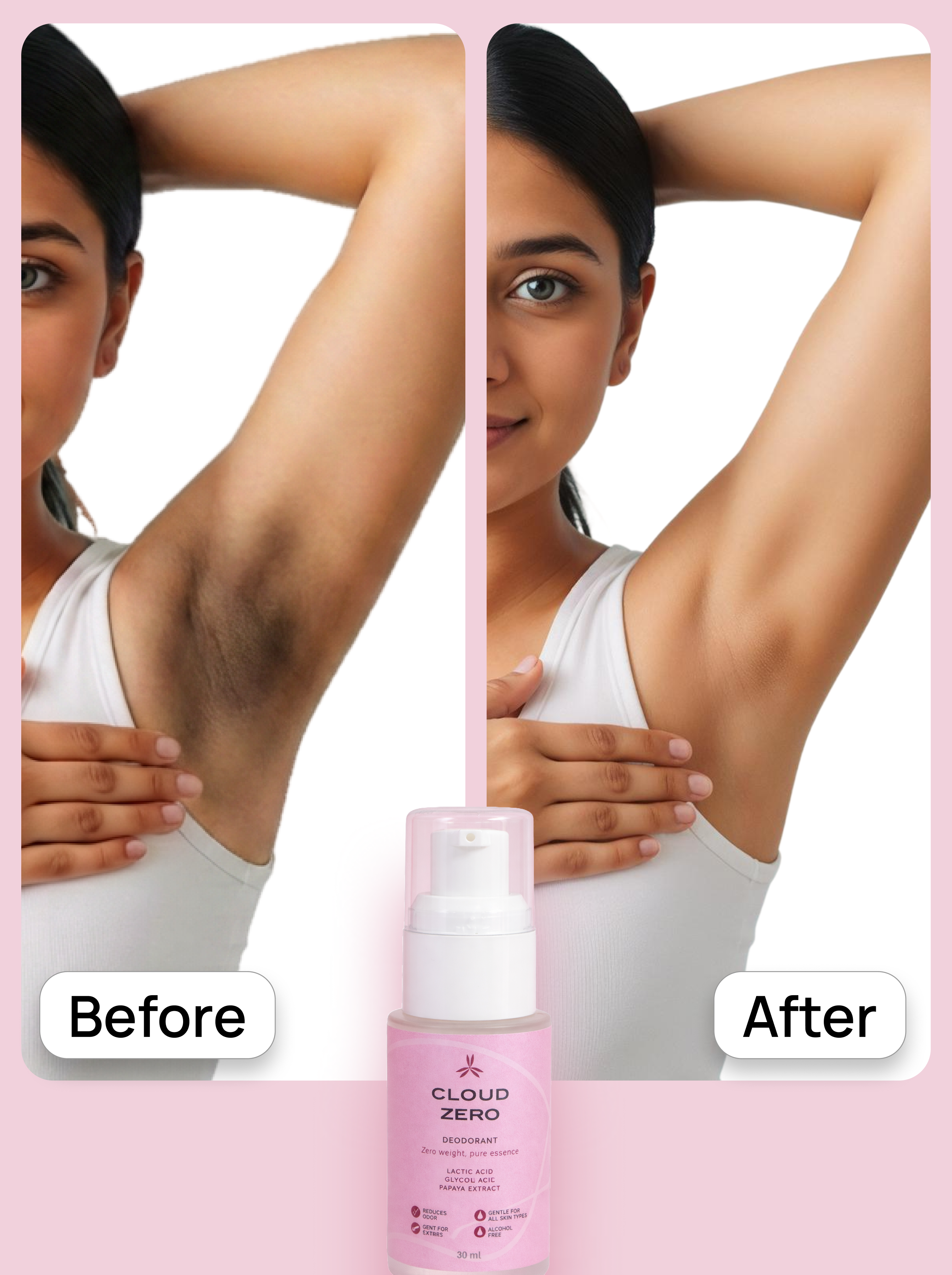 Before and after comparison of armpit hair with a bottle of Cloud Zero deodorant.