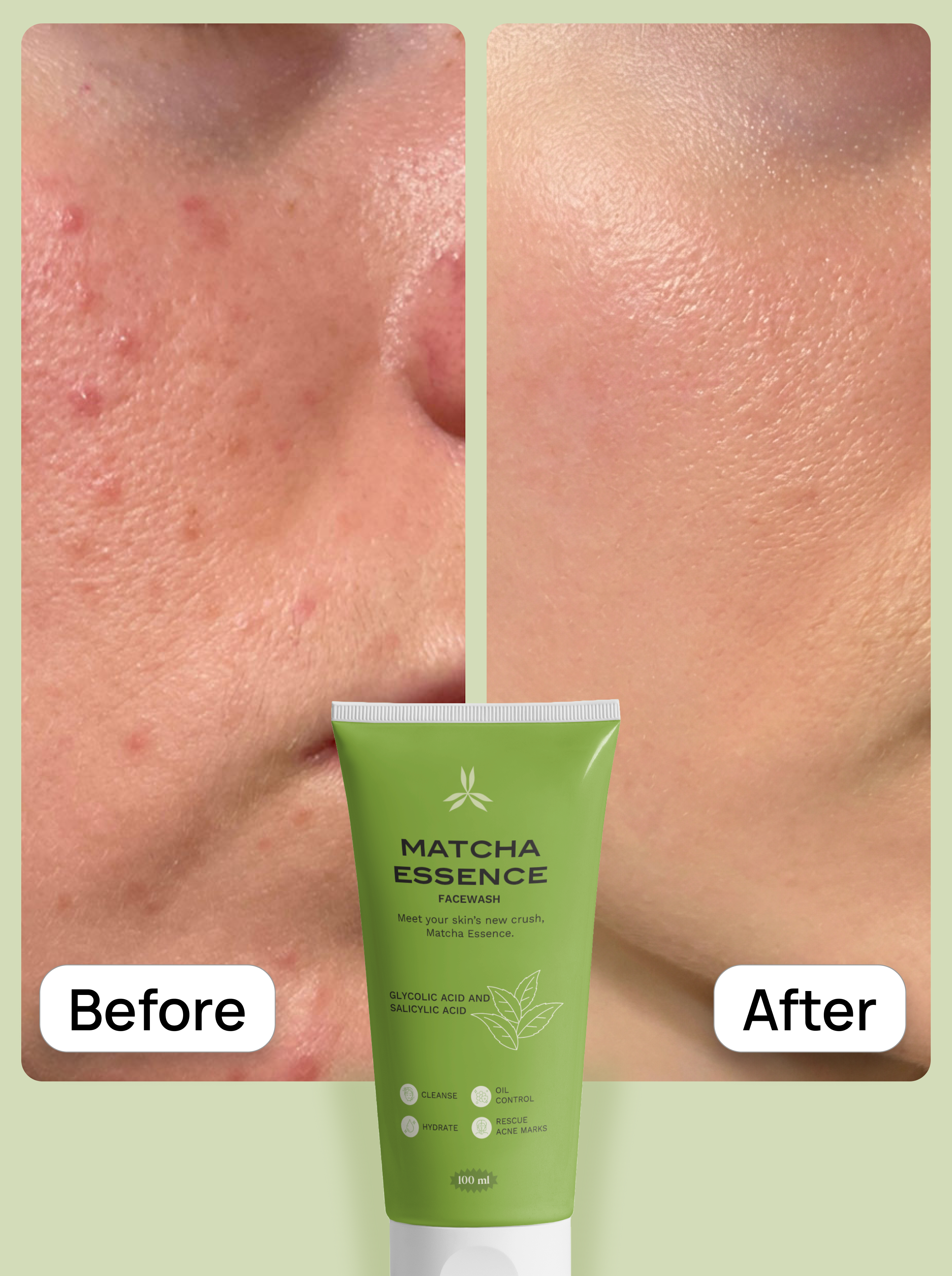Before and after comparison of skin with Matcha Essence Face Wash.