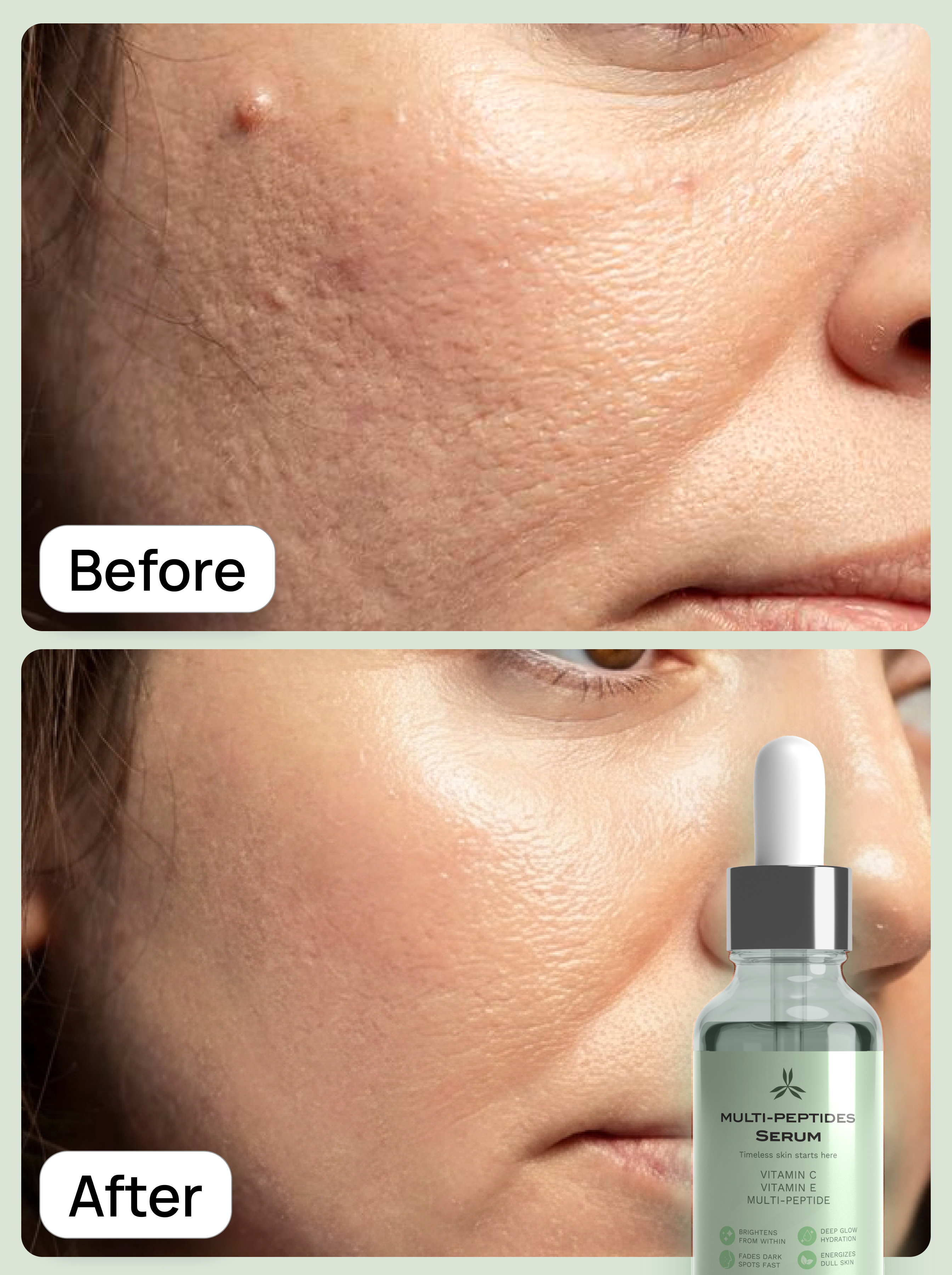 gloresense-multi-peptides-serum-before-after